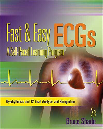 Fast 038 easy ECGs a selfpaced learning program 8211 2nd