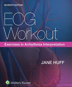 ECG Workout Exercises in Arrhythmia Interpretation 8211 7th