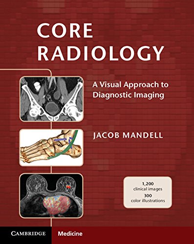 Core Radiology A Visual Approach to Diagnostic Imaging 8211 1st
