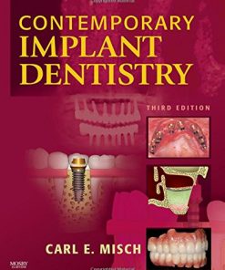 Contemporary Implant Dentistry