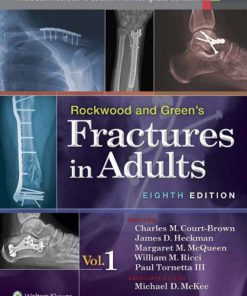 Rockwood and Green8217s Fractures in Adults Volume 1 8th 8E