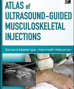 Atlas of UltrasoundGuided Musculoskeletal Injections