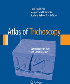 Atlas of Trichoscopy Dermoscopy in Hair and Scalp Disease 8211 1st