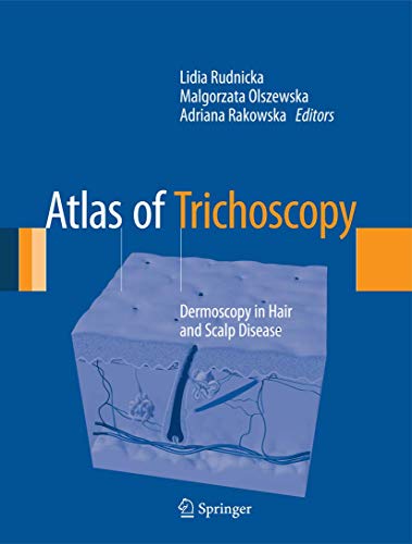 Atlas of Trichoscopy Dermoscopy in Hair and Scalp Disease 8211 1st