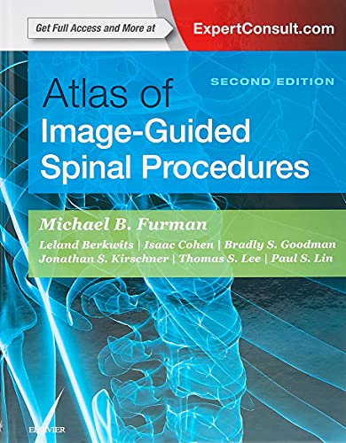 Atlas of ImageGuided Spinal Procedures 8211 2nd