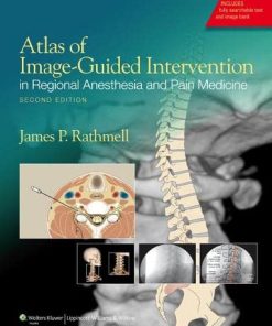 Atlas of ImageGuided Intervention in Regional Anesthesia and Pain Medicine 8211 2nd