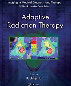 Adaptive radiation therapy