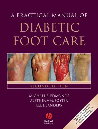 A Practical Manual of Diabetic Foot Care Second