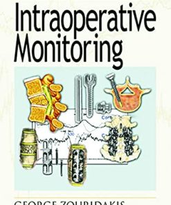 A Concise Guide to Intraoperative Monitoring