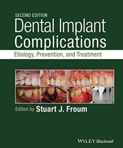 Dental Implant Complications Etiology Prevention and Treatment 2nd