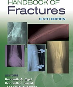 Handbook of Fractures 6th