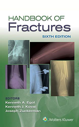 Handbook of Fractures 6th