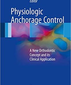 Physiologic Anchorage Control A New Orthodontic Concept and its Clinical Application