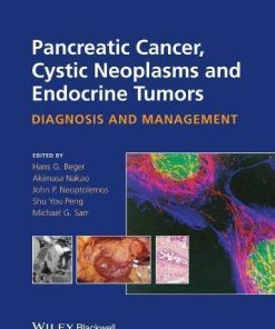 Pancreatic Cancer Cystic Neoplasms And Endocrine Tumors Diagnosis And Management
