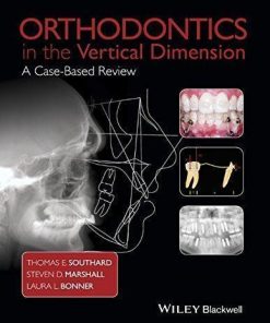 Orthodontics In The Vertical Dimension A Case Based Review