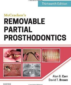 Mccrackens Removable Partial Prosthodontics 13Th