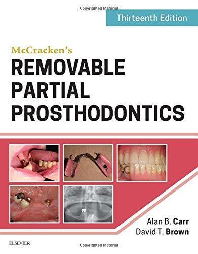 Mccrackens Removable Partial Prosthodontics 13Th
