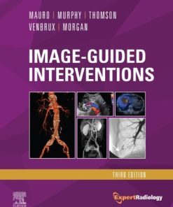 Image Guided Interventions Expert Radiology Series 3Rd