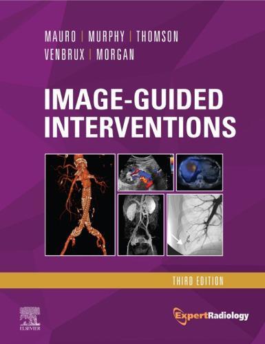 Image Guided Interventions Expert Radiology Series 3Rd