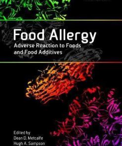 Food Allergy Adverse Reaction To Foods And Food Additives 5Th